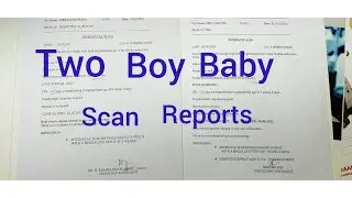 Two Boy Baby Full ScanRepors and major difference & placenta, Fhr and gender prediction in tamil