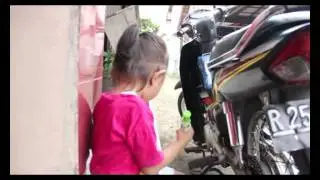 APERT SYNDROME Cilacap