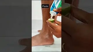 😱Rid Of Cracked Feet In 2minutes/Soft Smooth Feet Tips. #shorts #skincare #viral #feetcare #shorts