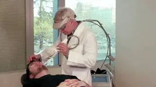 Excel V Laser Mountain View - Remove Facial & Nose Spider Veins