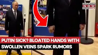 Putin Sick? Bloated Hands With Swollen Veins Spark Illness Rumour | Watch Shocking Visuals Of Fists