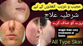 Acne scars treatment | Acne scras treatment at home remedies || acne scars removal cream in Pakistan