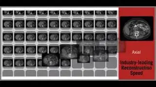 Accelerated Workflow with the VeloCT Console Upgrade