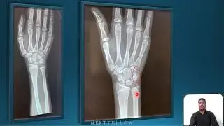 Forensic medicine ESTIMATION OF AGE  part 2 concept for NEETPG,FMGE,INICET,NEXT.