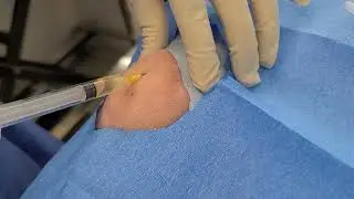 Platelet Rich Plasma at Marine and Fraser veterinary Clinic Vancouver