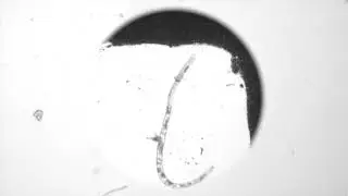 Meloidogyne aka Root Knot Nematode viewed at 10x magnification