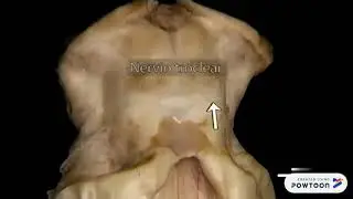 mesencefalo