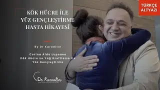 K&ouml;k H&uuml;cre İle Y&uuml;z Gen&ccedil;leştirme- Hasta Hikayesi- DR. KARAALTIN