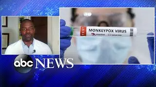 FDA expands monkeypox vaccine access by dividing doses