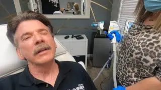 Alma Harmony XL Pixel Erbium treatment