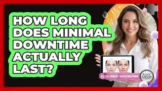 How Long Does Minimal Downtime Actually Last?