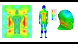 Моделирование SAR на системе МРТ с помощью ANSYS HFSS