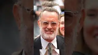Celebrities before and after #shorts #fyp #viral #plasticsurgery #aging #beforeandafter