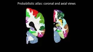 NextBrain project: Atlas Building