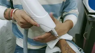 Tattoo removal and laser treatment