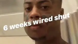 BOONK GETS HIS JAW BROKEN FULL FIGHT VIDEO