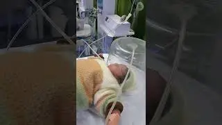 Low oxygen saturation in newborn #drnajeeb #doctor