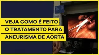 Como é feito o tratamento de aneurisma de aorta