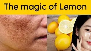 Lemon face pack for dark spots | Lemon and sugar face scrub for pigmentation and skin whitening