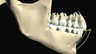 occlusodontie   sh&eacute;mas de Posselt