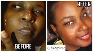 USING MARY KAY CLEAR PROOF ACNE SYSTEM FOR  WEEK | SKIN CARE ROUTINE