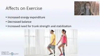 Lower Limb Amputation