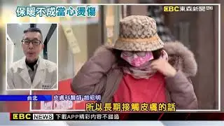 暖手器、暖暖包易釀「低溫燙傷」！ 醫：勿用逾半小時@newsebc