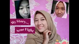 My acne story || Eva Rdsh