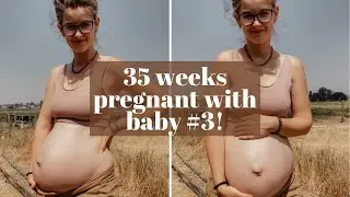 Pubic bone speration, braxton hicks contractions, prodromal labbor | My 35 week pregnancy update!