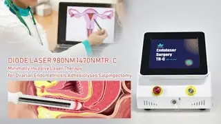 980nm 1470nm Gynecological Laser Vaginal Tightening Machine Triangel TR-C