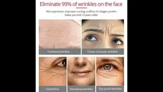 #Shorts: Fonce Korea Anti Aging Wrinkle Remover Face Cream -AliExpress Gadgets 2021