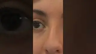 Unintentional asmr eye examination