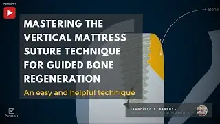 Mastering the Vertical Mattress Suture Technique for Guided Bone Regeneration