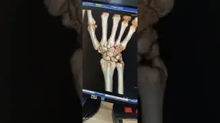 Ct Scan 3D images Ge 32Slice radiology 2022