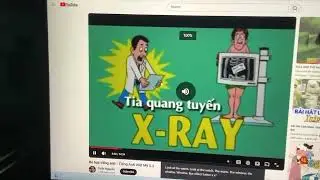 The Picture Starts With Letter X