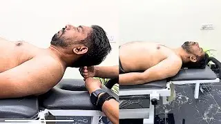 I Fixed His Hunchback with Chiropractic!