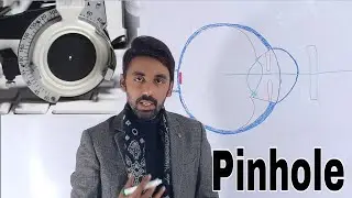 Pinhole, Position, Principal, Optics and uses of PINHOLE