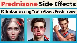 The 15 Prednisone Side Effects Your Doctor is PRAYING You Don't Discover