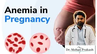 OPD Case Discussion | Anemia in Pregnancy | Clinical Examination & Management Explained