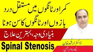 Spinal Stenosis Causes, Symptoms & Treatment | Complete Guide to Back Pain Relief