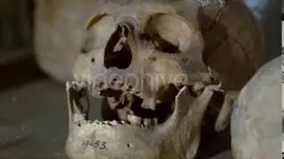 This Close-Up of a Skull. Many do Not Have the Teeth in Place