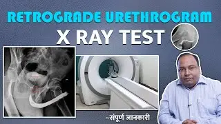 What is Retrograde Urethrogram Test ? | क्यों किया जाता है और क्या है इसकी प्रक्रिया ?