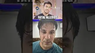 Allergic Reaction on Set? Pranay Reveals What Happened