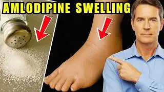 Swollen Ankles on Amlodipine? Avoid These 5 Mistakes