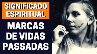 MARCAS DE NASCENÇA NA VISÃO ESPÍRITA I Mensagem Canal Espírita