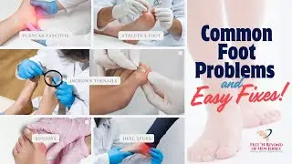Bunions, Heel Pain and Among Other  Common Foot Issues 😢