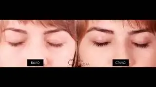 Lurey Lash MD результат использования в течение 8 недель