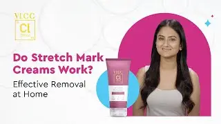 Tried Everything? Try This Stretch Mark Reduction Cream That Actually Works