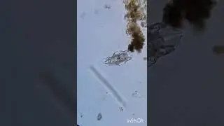 Mytilina rotifer