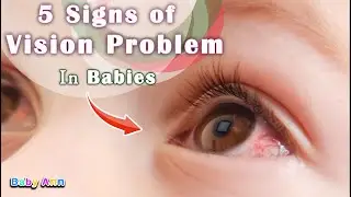 5 Signs of Vision Problem in Babies | Common Eye Problems in Babies | Common Eye Problems in Babies